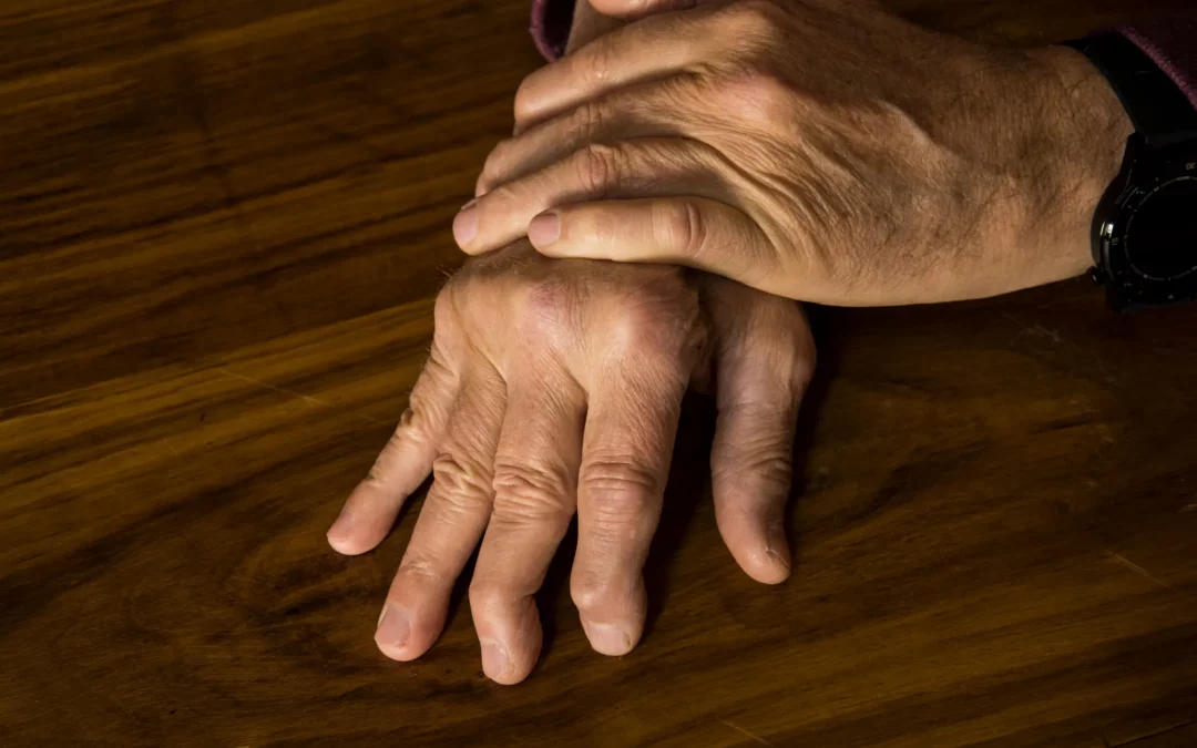 What Is Psoriatic Arthritis? How Can I Treat It? How Can I Cure It?